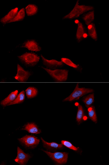 ICC/IF analysis of U2OS cell using GTX54146 GDNF Receptor alpha 1 antibody. Blue : DAPI