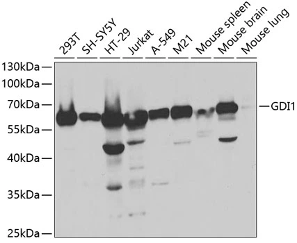 WB analysis of various sample lysates using GTX54148 GDI1 antibody. Dilution : 1:1000 Loading : 25microg per lane WB analysis of various sample lysates using GTX54148 GDI1 antibody. Dilution : 1:1000 Loading : 25microg per lane