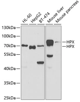 WB analysis of various sample lysates using GTX54150 Hemopexin antibody. Dilution : 1:1000 Loading : 25microg per lane WB analysis of various sample lysates using GTX54150 Hemopexin antibody. Dilution : 1:1000 Loading : 25microg per lane
