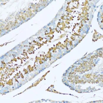 IHC-P analysis of rat testis tissue using GTX54150 Hemopexin antibody. Dilution : 1:100