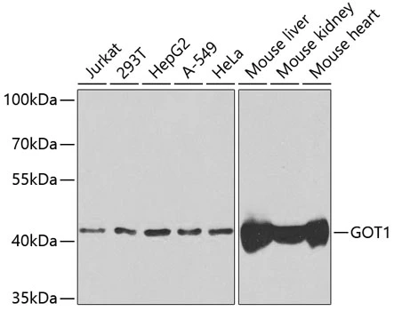 WB analysis of various sample lysates using GTX54155 GOT1 antibody. Dilution : 1:1000 Loading : 25microg per lane WB analysis of various sample lysates using GTX54155 GOT1 antibody. Dilution : 1:1000 Loading : 25microg per lane