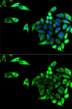 ICC/IF analysis of U2OS cells using GTX54155 GOT1 antibody. Blue : DAPI