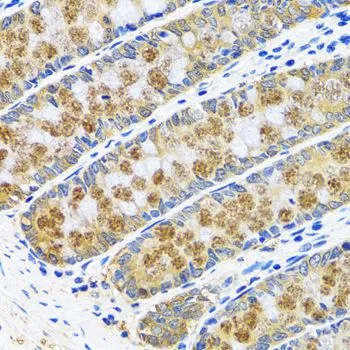 IHC-P analysis of human colon tissue using GTX54155 GOT1 antibody. Dilution : 1:100