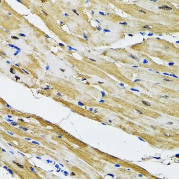 IHC-P analysis of rat heart tissue using GTX54155 GOT1 antibody. Dilution : 1:100
