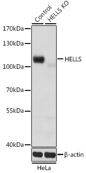 WB analysis of normal (control) and knockout (KO) HeLa cell lysate using GTX54157 HELLS antibody. Dilution : 1:1000 Loading : 25microg per lane