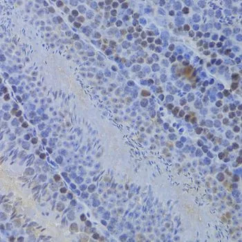 IHC-P analysis of mouse testis tissue using GTX54157 HELLS antibody. Dilution : 1:100