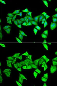 ICC/IF analysis of U2OS cells using GTX54162 H6PD antibody. Blue : DAPI