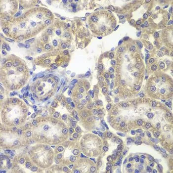IHC-P analysis of rat kidney tissue using GTX54162 H6PD antibody. Dilution : 1:200