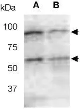 WB analysis of (A) zebrafish embryonic lysate (72 hpf) and (B) zebrafish lysate (6 dpf) usong Mmp14a antibody.
