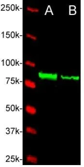 WB analysis of lysates from (A) zebrafish embryo (5 dpf) and (B) zebrafish embryo (48 hpf) using Ctnnb1 antibody.