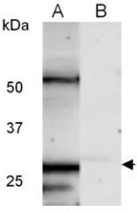 WB analysis of zebrafish embryonic lysate (48 hpf) using Pcna antibody in the (A) absence or (B) presence of blocking peptide.