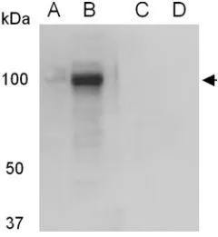 WB analysis of lysates from (A, C) zebrafish (5 dpf) and (b, d) ZF cells using Rb1 antibody in the (A, B) absence or (C, D) presence of blocking peptide. WB analysis of lysates from (A, C) zebrafish (5 dpf) and (b, d) ZF cells using Rb1 antibody in the (A, B) absence or (C, D) presence of blocking peptide.