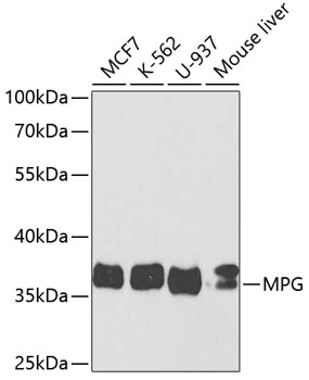 WB analysis of various sample lysates using GTX54286 MPG antibody. The signal was developed with ECL plus-Enhanced. Dilution : 1:1000 Loading : 25microg per lane WB analysis of various sample lysates using GTX54286 MPG antibody. The signal was developed with ECL plus-Enhanced. Dilution : 1:1000 Loading : 25microg per lane