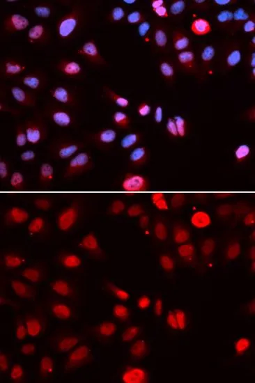 ICC/IF analysis of U2OS cells using GTX54286 MPG antibody. Blue : DAPI