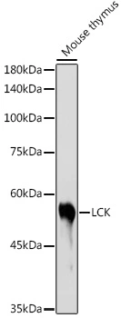 WB analysis of mouse thymus tissue lysate using GTX54287 Lck antibody. Dilution : 1:1000 Loading : 25microg per lane WB analysis of mouse thymus tissue lysate using GTX54287 Lck antibody. Dilution : 1:1000 Loading : 25microg per lane