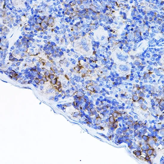IHC-P analysis of mouse spleen tissue using GTX54287 Lck antibody. Dilution : 1:100