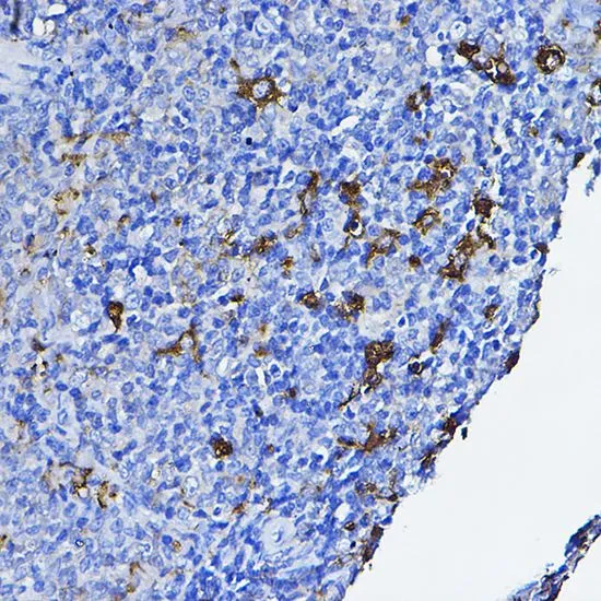 IHC-P analysis of rat spleen tissue using GTX54287 Lck antibody. Dilution : 1:100