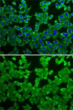 ICC/IF analysis of A549 cells using GTX54291 MTAP antibody. Blue : DAPI