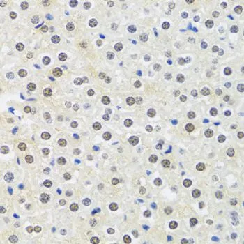IHC-P analysis of mouse liver tissue using GTX54291 MTAP antibody. Dilution : 1:100