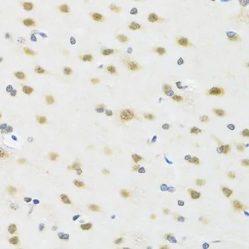 IHC-P analysis of rat brain tissue using GTX54291 MTAP antibody. Dilution : 1:100