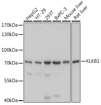 WB analysis of various sample lysates using GTX54292 Plasma Kallikrein 1B antibody. Dilution : 1:1000 Loading : 25microg per lane WB analysis of various sample lysates using GTX54292 Plasma Kallikrein 1B antibody. Dilution : 1:1000 Loading : 25microg per lane