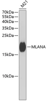 WB analysis of M21 cell lysate using GTX54303 Melan A antibody. Dilution : 1:1000 Loading : 25microg per lane WB analysis of M21 cell lysate using GTX54303 Melan A antibody. Dilution : 1:1000 Loading : 25microg per lane