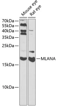 WB analysis of various sample lysates using GTX54303 Melan A antibody. The signal was developed with ECL plus-Enhanced. Dilution : 1:3000 Loading : 25microg per lane