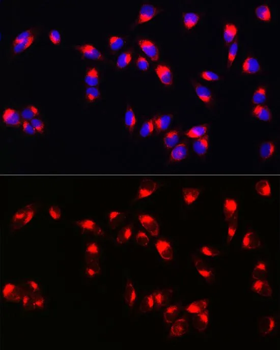 ICC/IF analysis of U2OS cells using GTX54303 Melan A antibody. Blue : DAPI