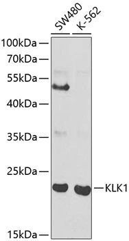 WB analysis of various sample lysates using GTX54309 Kallikrein 1 antibody. Dilution : 1:1000 Loading : 25microg per lane WB analysis of various sample lysates using GTX54309 Kallikrein 1 antibody. Dilution : 1:1000 Loading : 25microg per lane