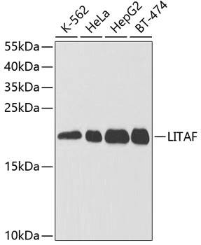 WB analysis of various sample lysates using GTX54315 LITAF antibody. Dilution : 1:1000 Loading : 25microg per lane