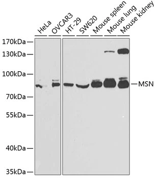 WB analysis of various sample lysates using GTX54327 Moesin antibody. Dilution : 1:1000 Loading : 25microg per lane WB analysis of various sample lysates using GTX54327 Moesin antibody. Dilution : 1:1000 Loading : 25microg per lane