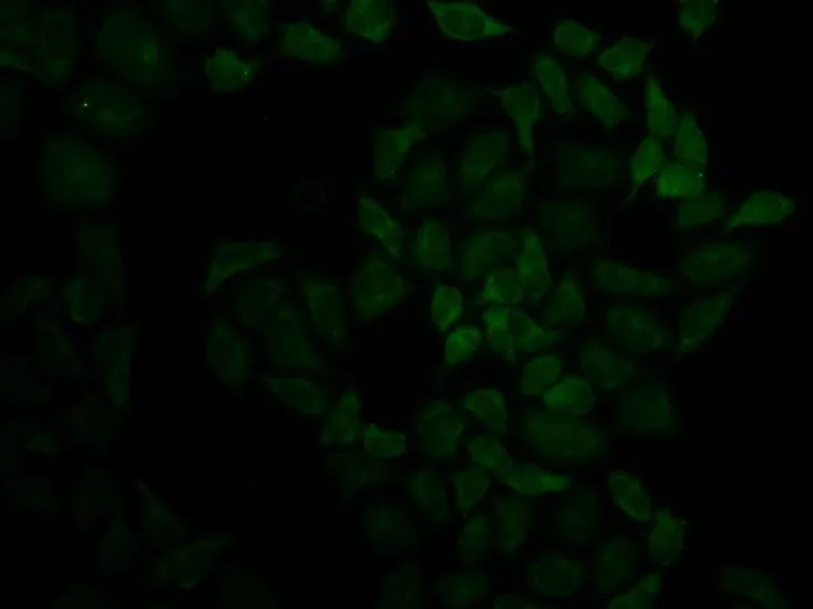 ICC/IF analysis of HeLa cells using GTX54327 Moesin antibody.