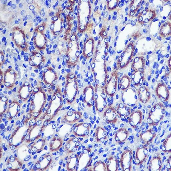 IHC-P analysis of mouse kidney tissue using GTX54331 LETMD1 antibody. Dilution : 1:100