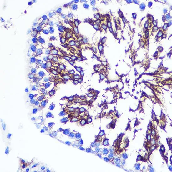 IHC-P analysis of rat testis tissue using GTX54331 LETMD1 antibody. Dilution : 1:100