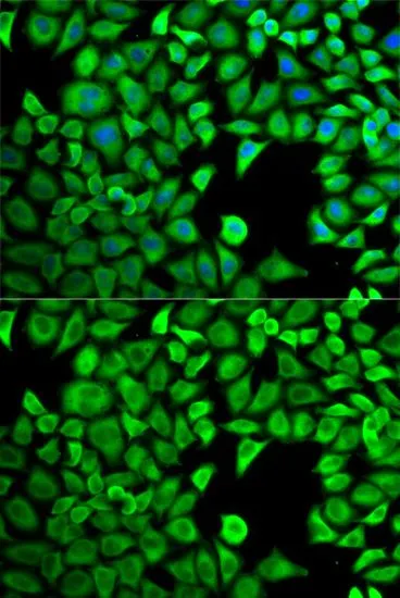 ICC/IF analysis of HeLa cells using GTX54332 LTA4H antibody. Blue : DAPI