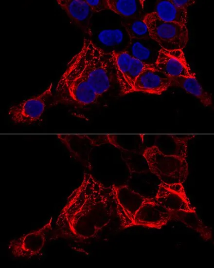ICC/IF analysis of A431 cells using GTX54340 Cytokeratin 20 antibody. Blue : DAPI Dilution : 1:200