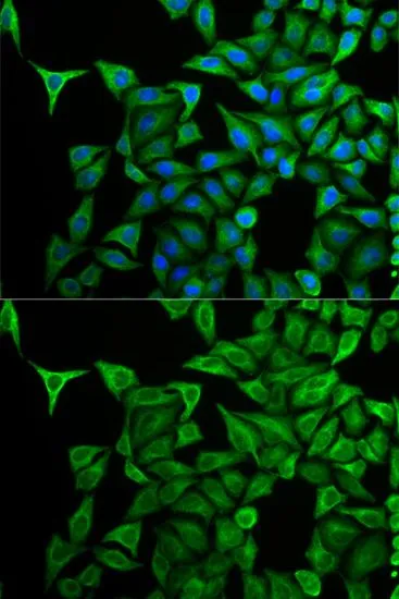 ICC/IF analysis of HeLa cells using GTX54340 Cytokeratin 20 antibody. Blue : DAPI