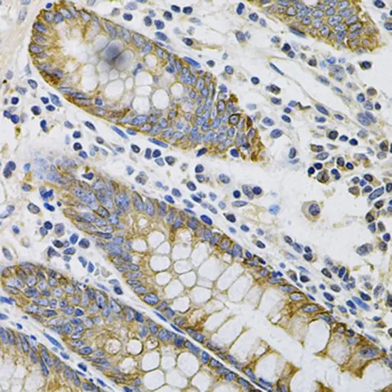 IHC-P analysis of human colon tissue using GTX54340 Cytokeratin 20 antibody. Dilution : 1:100