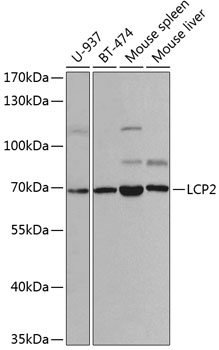WB analysis of various samples using GTX54341 SLP76 antibody. Dilution : 1:1000 Loading : 25ug per lane