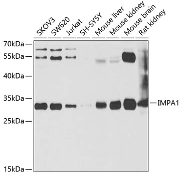 WB analysis of various sample lysates using GTX54348 IMPA1 antibody. Dilution : 1:1000 Loading : 25microg per lane WB analysis of various sample lysates using GTX54348 IMPA1 antibody. Dilution : 1:1000 Loading : 25microg per lane