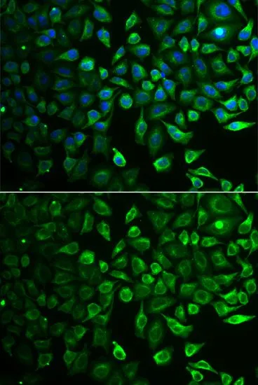 ICC/IF analysis of A549 cells using GTX54348 IMPA1 antibody. Blue : DAPI