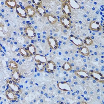 IHC-P analysis of rat kidney tissue using GTX54348 IMPA1 antibody. Dilution : 1:100