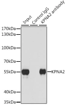 IP analysis of U-251MG cell lysate using GTX54349 KPNA2 antibody. Antibody amount : 3microg / 200microg lysate Dilution : 1:1000 IP analysis of U-251MG cell lysate using GTX54349 KPNA2 antibody. Antibody amount : 3microg / 200microg lysate Dilution : 1:1000