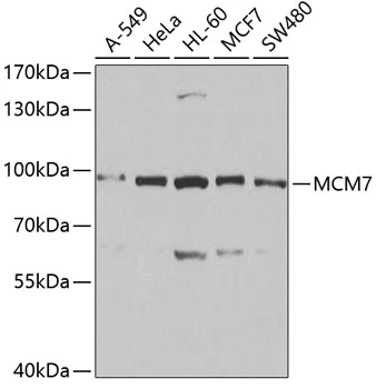 WB analysis of various sample lysates using GTX54354 MCM7 antibody. Dilution : 1:1000 Loading : 25microg per lane