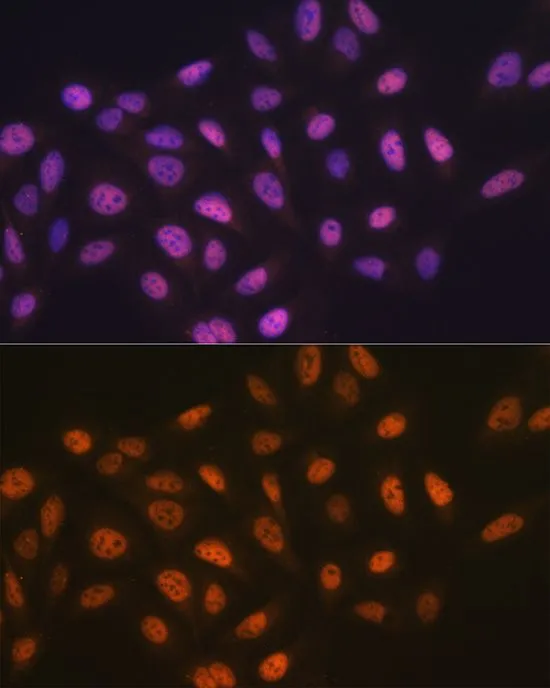 ICC/IF analysis of U2OS cells using GTX54354 MCM7 antibody. Blue : DAPI Dilution : 1:100