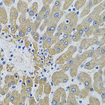 IHC-P analysis of human liver damage tissue using GTX54368 MBL2 antibody.