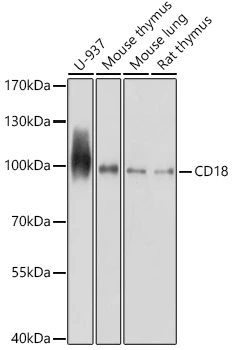 WB analysis of various sample lysates using GTX54372 CD18 antibody. Dilution : 1:1000 Loading : 25microg per lane WB analysis of various sample lysates using GTX54372 CD18 antibody. Dilution : 1:1000 Loading : 25microg per lane