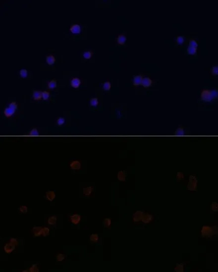ICC/IF analysis of Raw264.7 cells using GTX54372 CD18 antibody. Blue : DAPI Dilution : 1:100