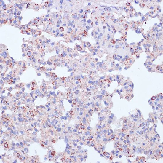 IHC-P analysis of rat lung tissue using GTX54372 CD18 antibody. Dilution : 1:100