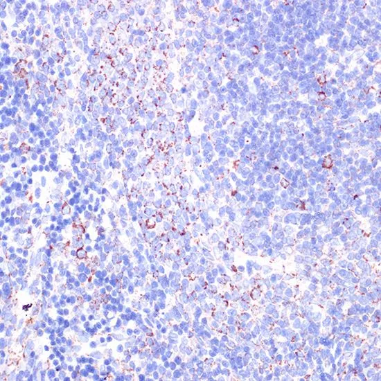 IHC-P analysis of rat spleen tissue using GTX54372 CD18 antibody. Dilution : 1:100